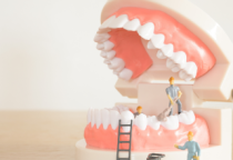 Những Thực Phẩm Tốt Cho Răng Miệng - Bí Quyết Giữ Răng Chắc Khỏe